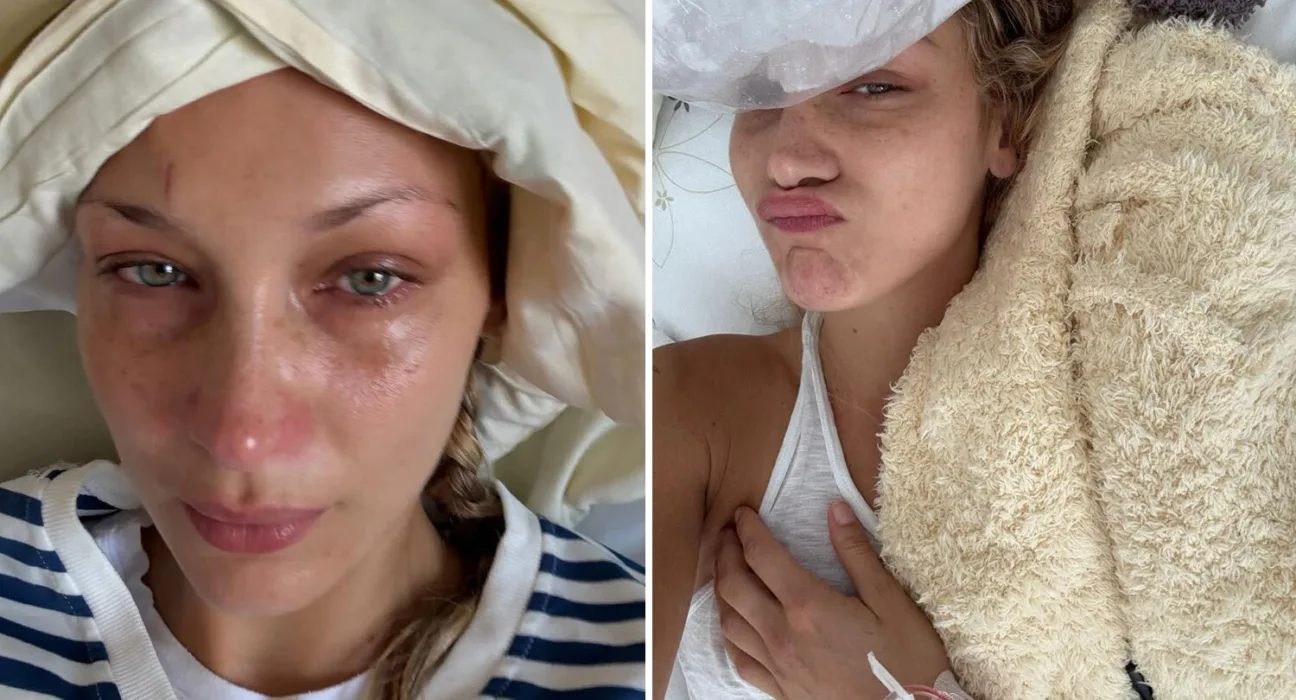 Dünyaca Ünlü Modelin Kabusu: Bella Hadid Lyme Hastalığıyla Mücadelede Zor Günler Yaşıyor
