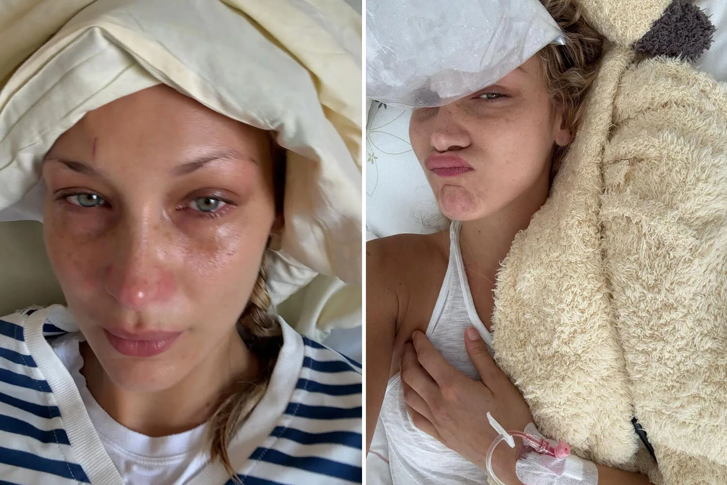 Dünyaca Ünlü Modelin Kabusu: Bella Hadid Lyme Hastalığıyla Mücadelede Zor Günler Yaşıyor